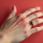 Frauenhand mit Ring, der zu einer Kontaktallergie geführt hat.