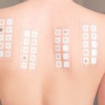 Frau mit eine Patch-Test auf dem Rücken.
