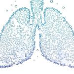 Gezeichnete Lunge die voller Wasserbläschen ist